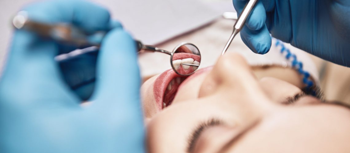 Close-up of woman opening her mouth wide during inspection of oral cavity. Dentist is checking up her teeth using dental tools. Medicine and health care concept. Focus on dental tools. Horizontal shot